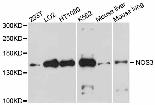 Western blot - NOS3 antibody (144-01548)