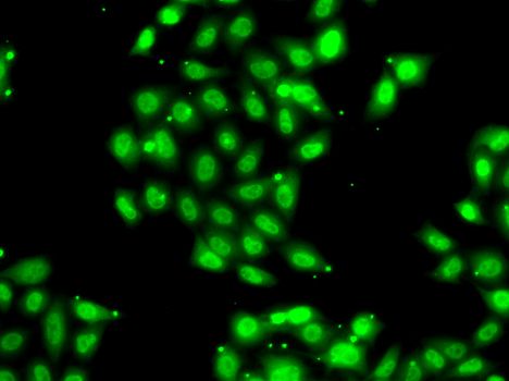 Western blot