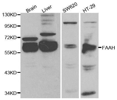 Western blot - FAAH antibody (144-01174)