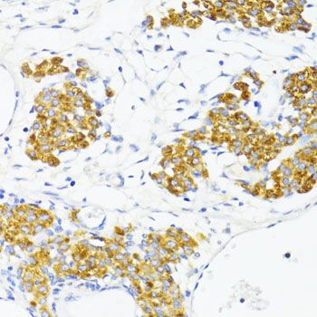 Immunohistochemistry - FN1 antibody (144-12932)