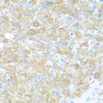 Immunohistochemistry - FGFR2 antibody (144-02074)