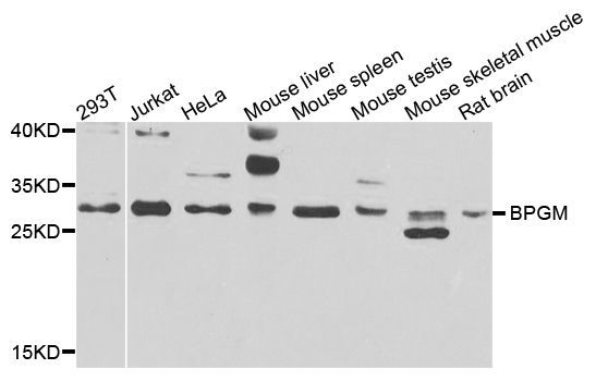 Western blot - BPGM antibody (144-07880)
