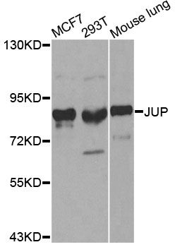 Western blot - JUP Polyclonal Antibody (144-00963)