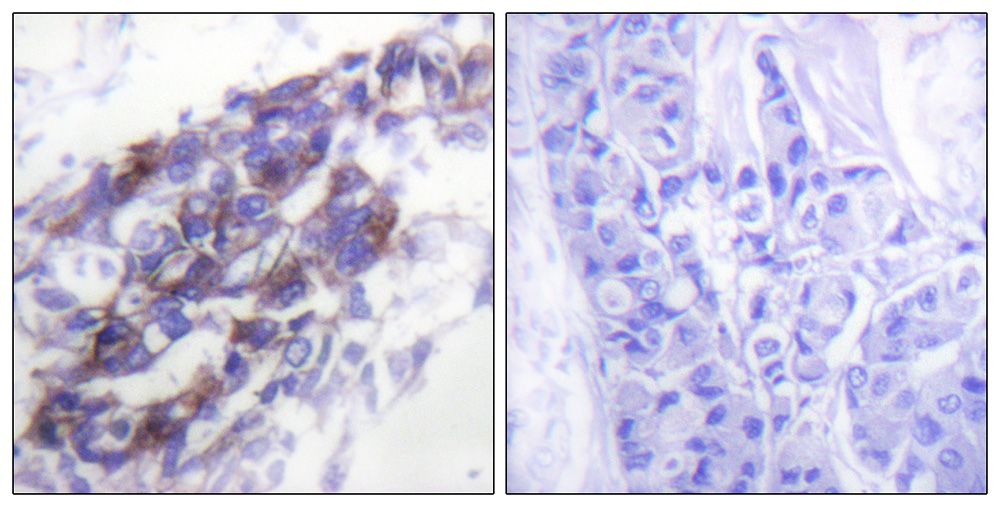 IHC