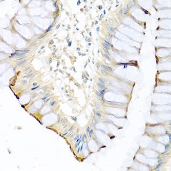 Immunohistochemistry - CPA1 antibody (144-03803)