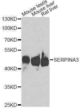 Western blot - SERPINA3 Polyclonal Antibody (144-01021)