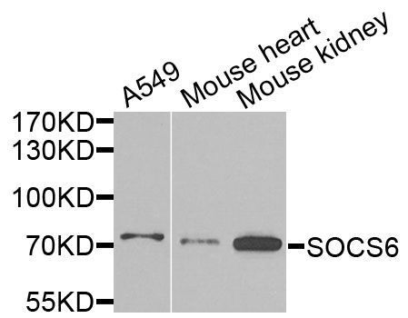 Western blot - SOCS6 antibody (144-09957)
