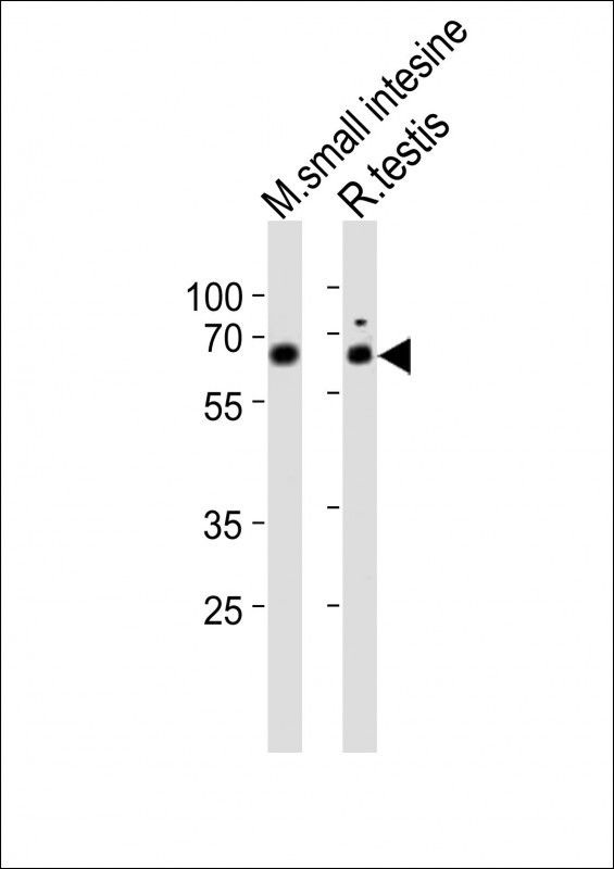 WB