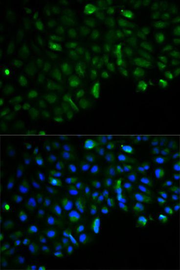 Immunohistochemistry - HK2 Polyclonal Antibody (144-00994)