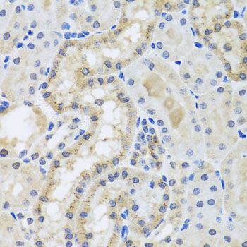 Immunohistochemistry - CETN3 antibody (144-08111)