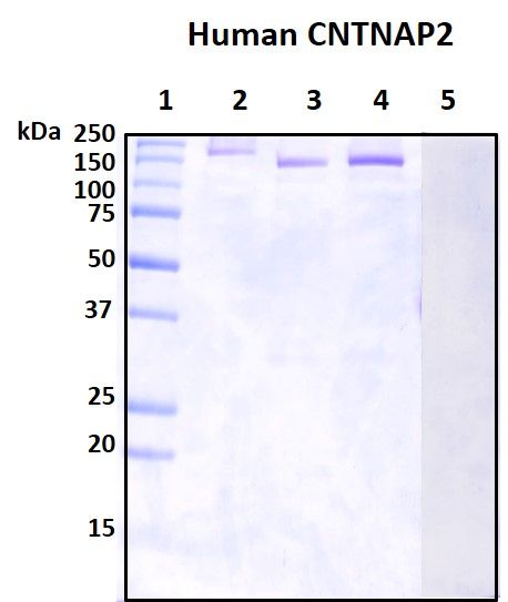 SDS-PAGE