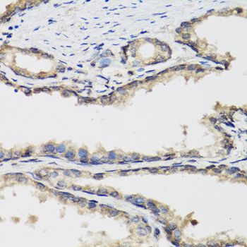 Immunohistochemistry - PLA2G7 antibody (144-61484)