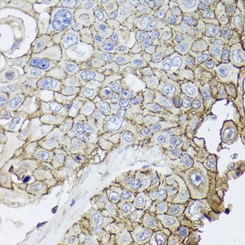 Immunohistochemistry - CD44 Polyclonal Antibody (144-00340)
