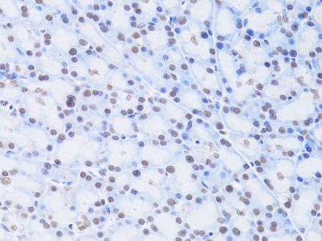 Immunohistochemistry - LMNB2 Polyclonal Antibody (144-06483)