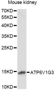 Western blot - ATP6V1G3 Polyclonal Antibody (144-60670)