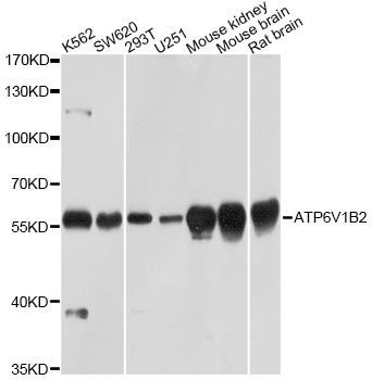 Western blot - ATP6V1B2 Polyclonal Antibody (144-03754)