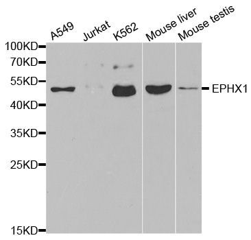 Western blot - EPHX1 antibody (144-02070)