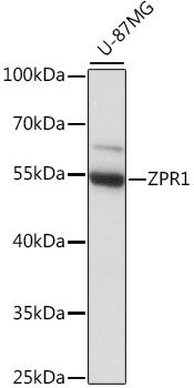 Western blot