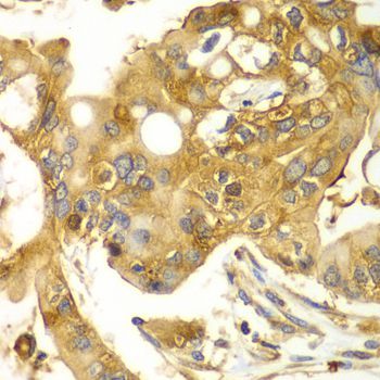 Immunohistochemistry - CAPNS1 antibody (144-06539)