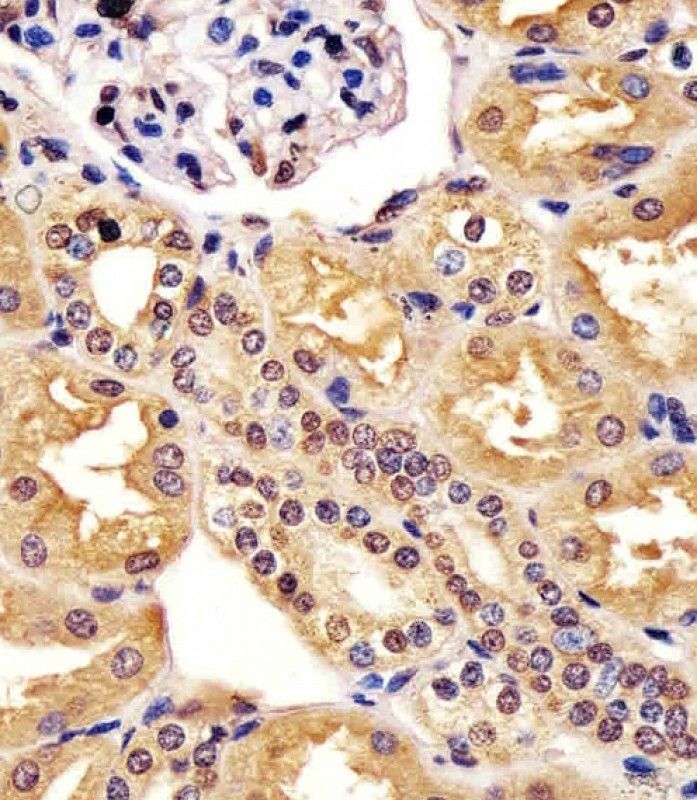 IHC-P