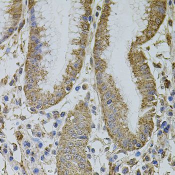 Immunohistochemistry - MTIF3 antibody (144-08524)