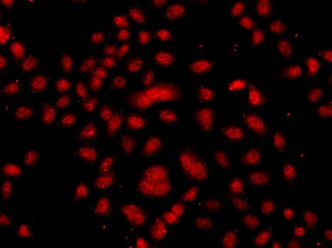Immunofluorescence - FBXW11 antibody (144-07784)