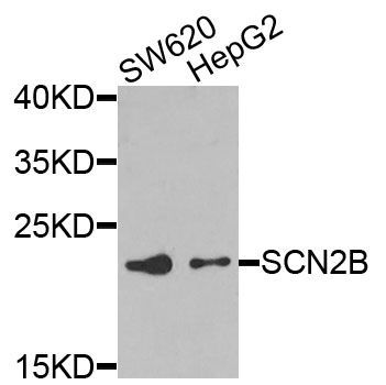 Western blot - SCN2B Polyclonal Antibody (144-07723)