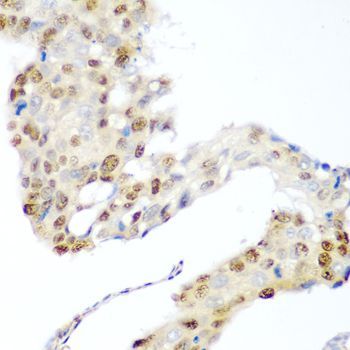 Immunohistochemistry - CDK1 antibody (144-012414)
