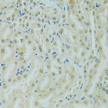 Immunohistochemistry - RCC1 Polyclonal Antibody (144-06350)