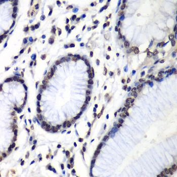 Immunohistochemistry - HNRNPM Polyclonal Antibody (144-06937)