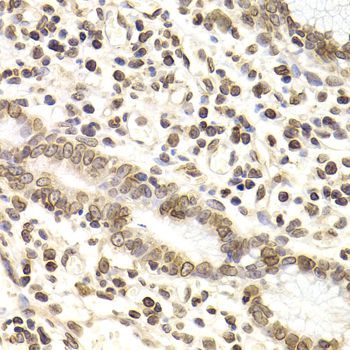 Immunohistochemistry - LMNB2 Polyclonal Antibody (144-06483)
