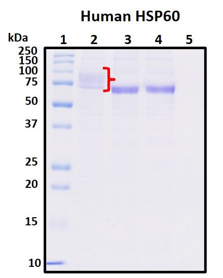 SDS-PAGE