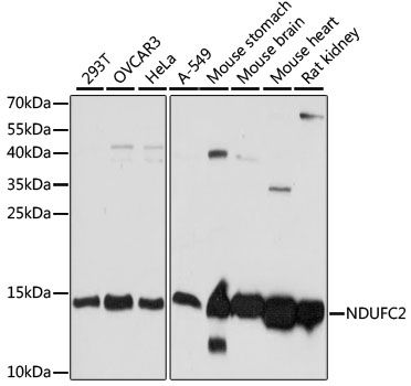 Western blot - [KO Validated] NDUFC2 Polyclonal Antibody (144-60903)