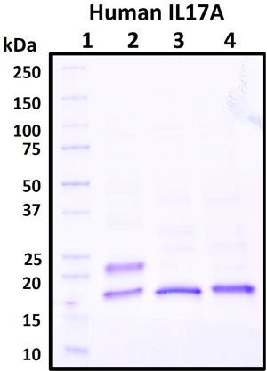 SDS-PAGE