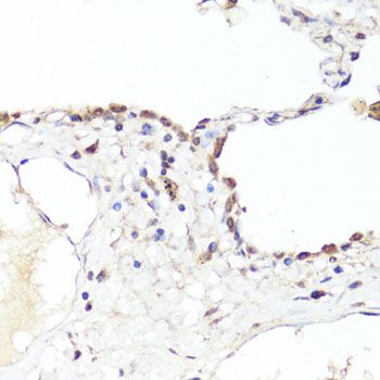 Immunohistochemistry - EGFR Polyclonal Antibody (144-011577)