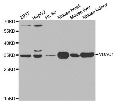 Western blot - VDAC1 Polyclonal Antibody (144-00810)