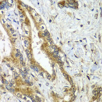 Immunohistochemistry - CDC16 antibody (144-07197)