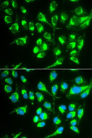 Immunofluorescence - SLC22A5 Polyclonal Antibody (144-01676)