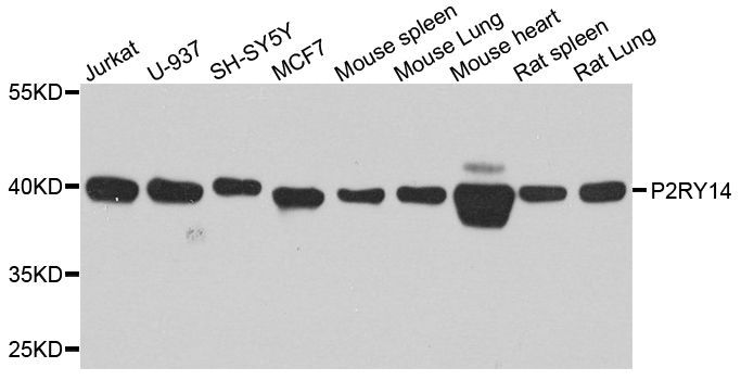Western blot - P2RY14 Polyclonal Antibody (144-08178)