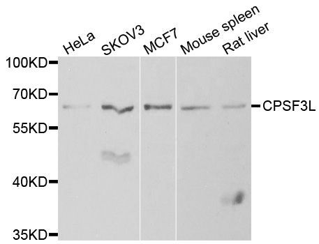 Western blot - CPSF3L antibody (144-06566)