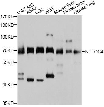 Western blot - NPLOC4 antibody (144-03256)