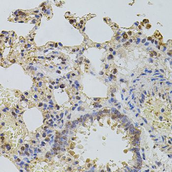 Immunohistochemistry - PLK4 antibody (144-09863)