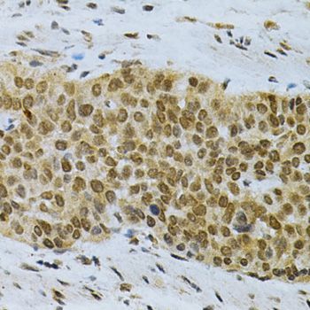 Immunohistochemistry - ELAVL1 Polyclonal Antibody (144-01608)