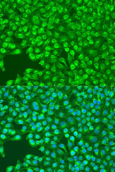 Immunofluorescence - SYK antibody (144-02123)