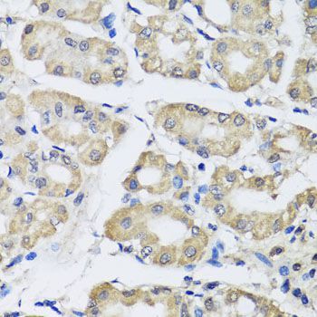 Immunohistochemistry - SCG3 Polyclonal Antibody (144-07799)