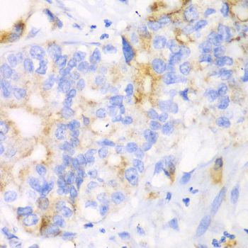 Immunohistochemistry - CHIA Polyclonal Antibody (144-61364)
