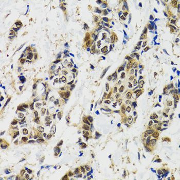 Western blot - [KO Validated] MAPK9 Polyclonal Antibody (144-01251)