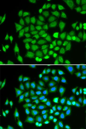 Immunofluorescence - AKR7A2 antibody (144-01227)