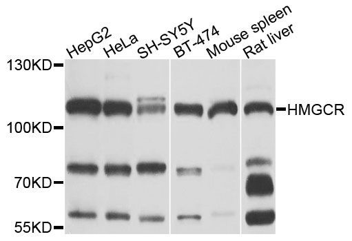 Western blot - HMGCR antibody (144-01633)