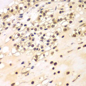 Immunohistochemistry - BCAS3 Polyclonal Antibody (144-07274)